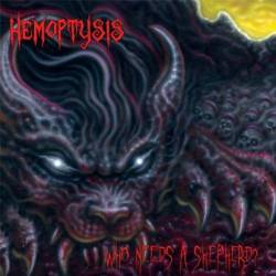 Hemoptysis : Who Needs a Shepherd?